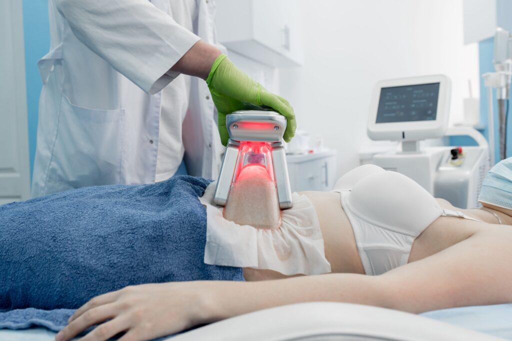 Kryolipolyse Behandlung_cleanskin.de